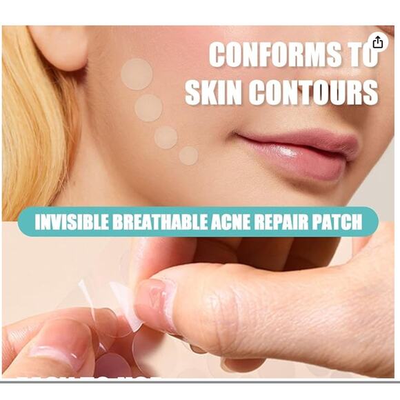 Pimple Patches, 3 Sizes Hydrocolloid Acne Patches, 156 ct. - Picture 2 of 7